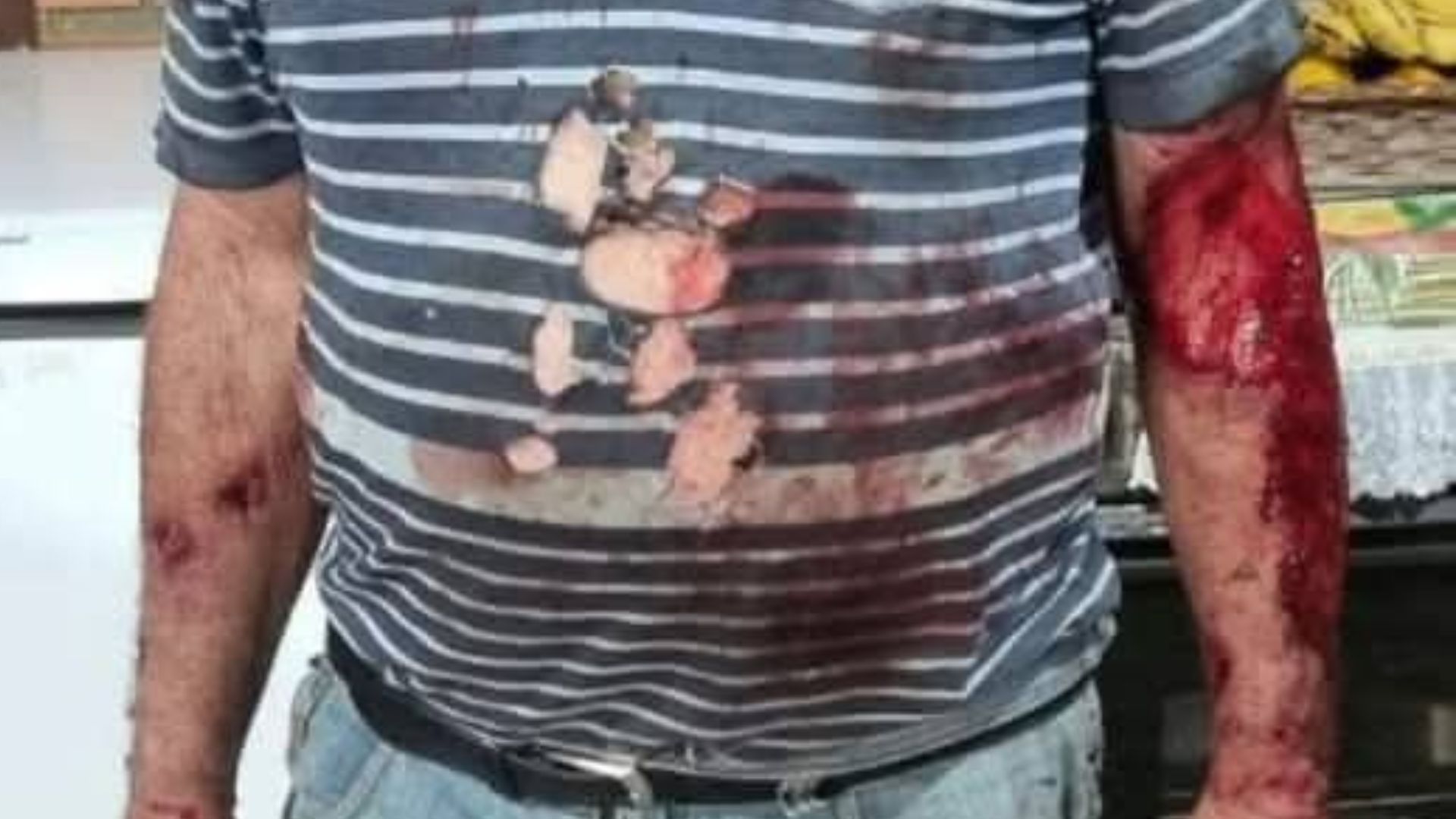 Agricultor é atacado por puma em Maquiné (RS); Prefeitura investiga caso