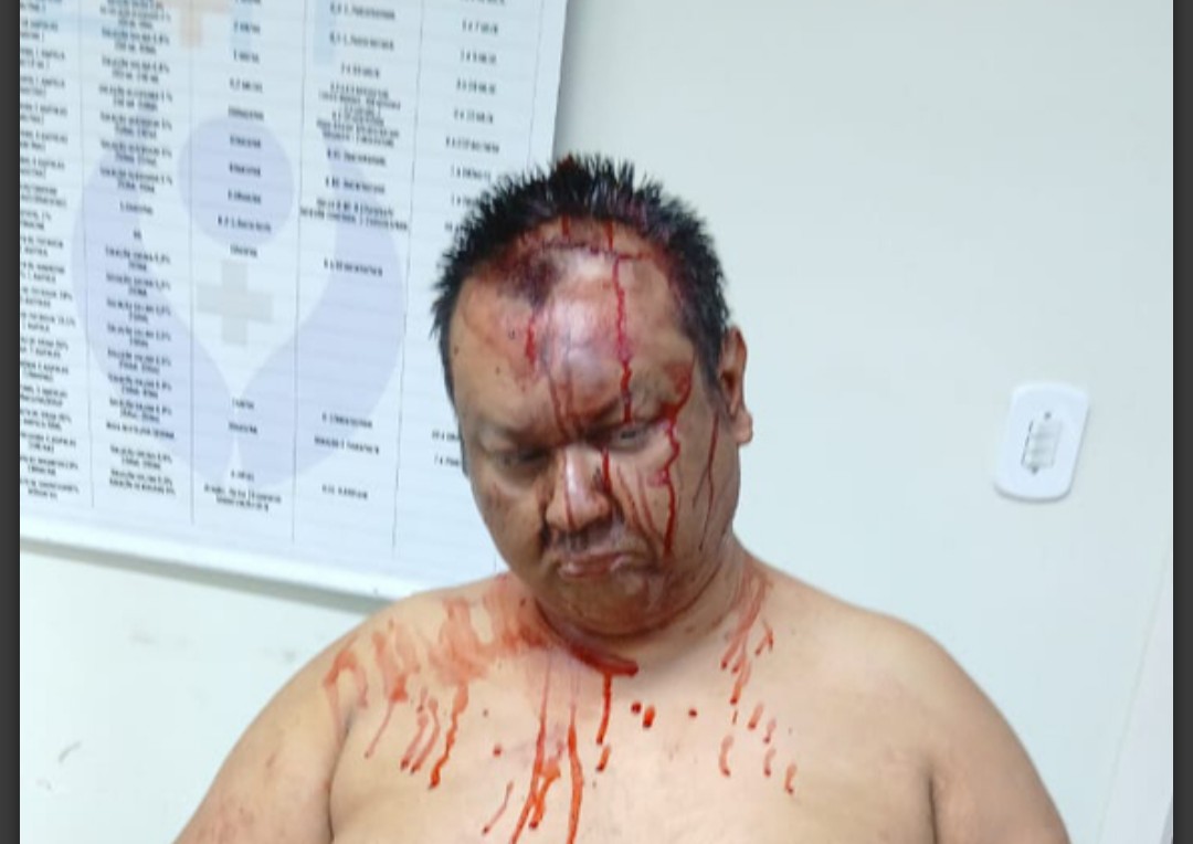 Homem com esquizofrenia é espancado por policiais civis em Uruguaiana