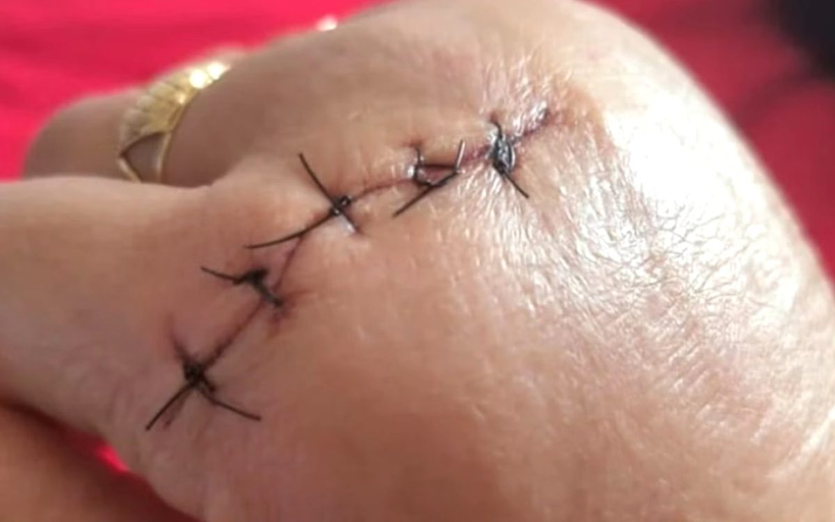 Aluna de 14 anos agride professora com faca e escola suspende aulas em Caseiros (RS)