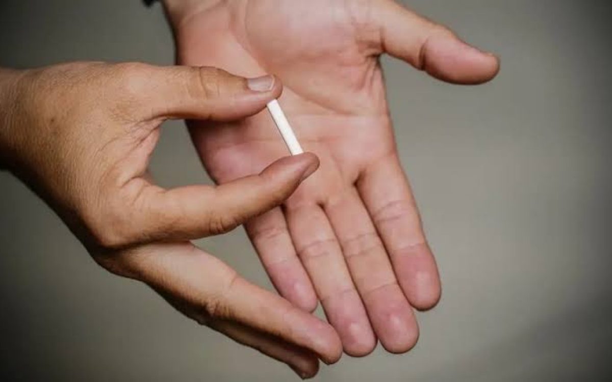 Implante contraceptivo de longa duração que custa até R$ 4 mil será oferecido pelo SUS
